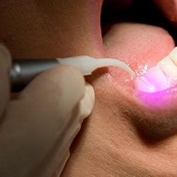 Patients receiving laser dental care